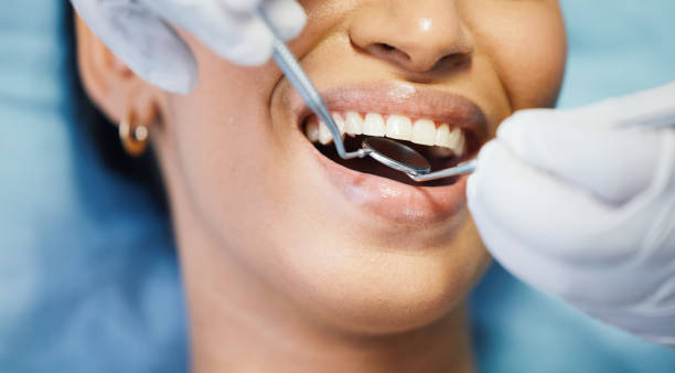 Best Dental Abscess Treatment in Rehoboth Beach, DE